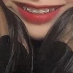 나 교정 했는데 웃는 거 별로야?
