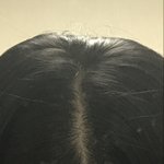 [댓글부탁해] 나 <b>탈모</b>인지 아닌지 좀 봐주라