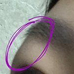 쌍수하고 1-2년 지난 사람 들어와봐