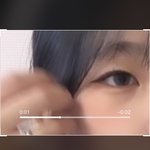 [드루와] +) 나 <b>쌍수</b> ㄹㅇ 해야되겟지? 봐바
