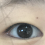 언니들 ㅠㅠ <b>쌍수</b>할까요말까요