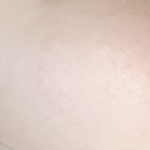 나 피부 조칭