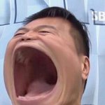 씨11발 쌍수 ㅈㄴ 얇게 됐네