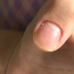 [댓글부탁해] <b>손톱</b> 바디가 줄어든건 뭐야?