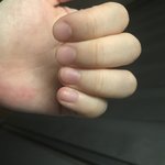 <b>손톱</b> 까끙ㅁ!!!!!!!