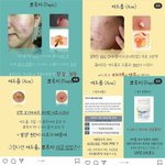 [댓글부탁해] 얘<b>드랑</b> 블러셔 바르면 나만 이런가