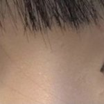 <b>짝눈</b> 많이 심해??????(빛삭