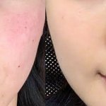 [이것좀봐줘] 최악의 피부를 가지고 있던 제가 알려드리는 피부 관련...