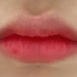이런 <b>윗입술</b> 비대칭도 교정할 수 있어ㅜㅜ?