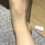 [댓글부탁해] 내 <b>발목</b> 뭔가 이상하디않냐?