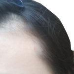 [드루와] M자 탈모 고민있는 사람들 들어<b>와바</b> 작은 팁 알려줄게