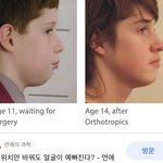 [드루와] 혀위치 바꾸니깐 확실히 얼굴형이 달라보임