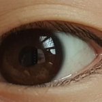 아니 하루아침에 <b>속쌍</b> 생김 ;;