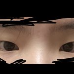 [드루와] 쌍수 어떤라인할까