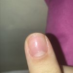 [ㅈㄱㄴ] 내<b>손톱</b> ㄹㅇ _병”신 ㅅㅂㅜ