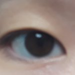 [드루와] 쌍수 할까? 으때