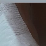 얘드라 <b>화상</b> 2도면 병원가야대??