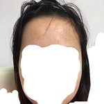 나 얼굴 ㅈㄴ <b>길음</b> 이마도 ㅈㄴ <b>길음</b>