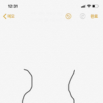 [댓글부탁해] 나 골반은 있는데 고관절이 없음