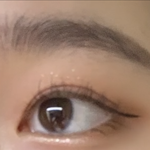 [이것좀봐줘] <b>쌍수티</b>안나는거 스틀에스야..