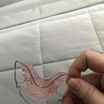 걍 교정하면 유지장치 평생 낀다 생각<b>하삼</b>