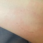 여자들 깨물고 [<b>사진</b>있음] [<b>데이트</b>폭력?]