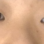 코 <b>보정</b>으로 줄였는데
