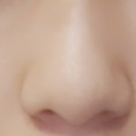 [댓글부탁해] 코수술 조언해줘! (<b>사진o</b>)