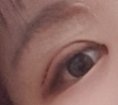 쌍수 5일찬데 이정도면 나중에 <b>속쌍</b> 됨?