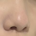 코 <b>쉐딩</b> ㅇㄸ ㅠㅠㅠ?