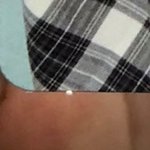 [NCT즌] 뜯긴 <b>자국</b> 이런거임