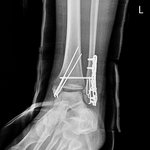 호텔 청소 경험담