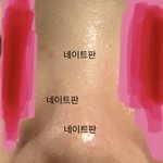 [드루와] 나 코수술 할까