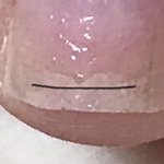 [댓글부탁해] 내손톱 개병0<b>신년</b> 왜이래?