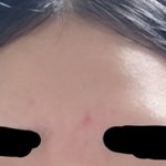 나 <b>이마</b> 좁은편이야??