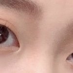 [댓글부탁해] 나 <b>짝눈</b> 차이 많이 심하지?? ㅠㅠ