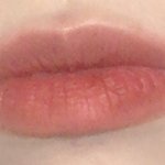 얘들아 나 입술필러 할말 <b>사진O</b>