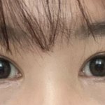 [댓글부탁해] 쌍수한지 일년반 정도 됐는데 <b>재수술</b> 해야될까?ㅜㅜ