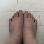 [드루와] ㅅㅂ나 수족냉증 조카 <b>심각</b>한 듯ㅋㅋㅋㅋㅋㅋㅋㅋ