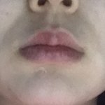 [댓글부탁해] 이런 <b>팔자</b>주름 어카냐 .. 필러다 답이냐