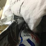 너희 <b>치아</b>에 금니 몇개있녀
