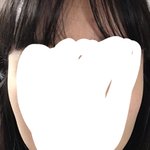 걍 교정하고 <b>땅콩</b>형 얼굴이 됐음 ㅋㅋㅋㅋ