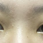 쌍수 어때 그리고 나 <b>꼬막</b><b>눈</b>이야?ㅠㅠ