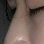 [꼭조언부탁] 19살 교정과 <b>코</b>수술 해야 할까요?