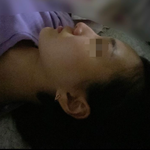 [댓글부탁해] 나 턱 <b>치아</b>교정하고 나서 ㅈㄴ 이상해짐ㅠㅠㅠ