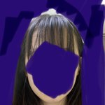 [댓글부탁해] 비대칭 <b>이빨</b>교정하면 괜찮아져?