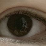 <b>쌍수티</b> 많이나??