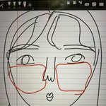 [댓글부탁해] 나 쌍수했는데 붓기가 ㅜ