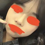 나 <b>중안면부</b> 긺?