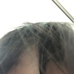나 <b>왕눈이</b> 가능?